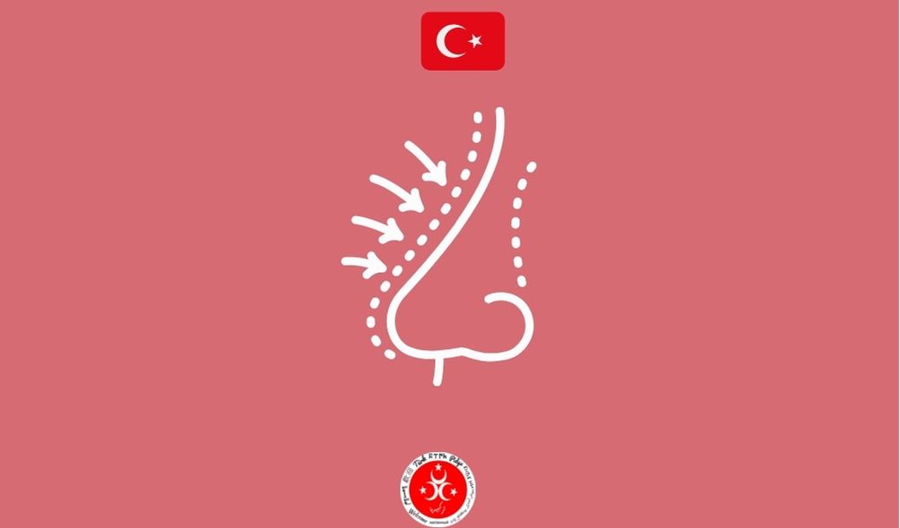 Nasenoperationen in der Türkei