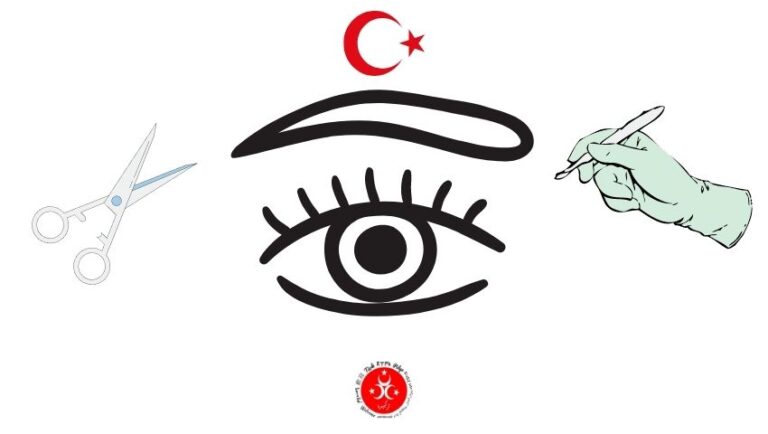 Greffe de sourcils en Turquie… Tout ce que vous devez savoir 2023
