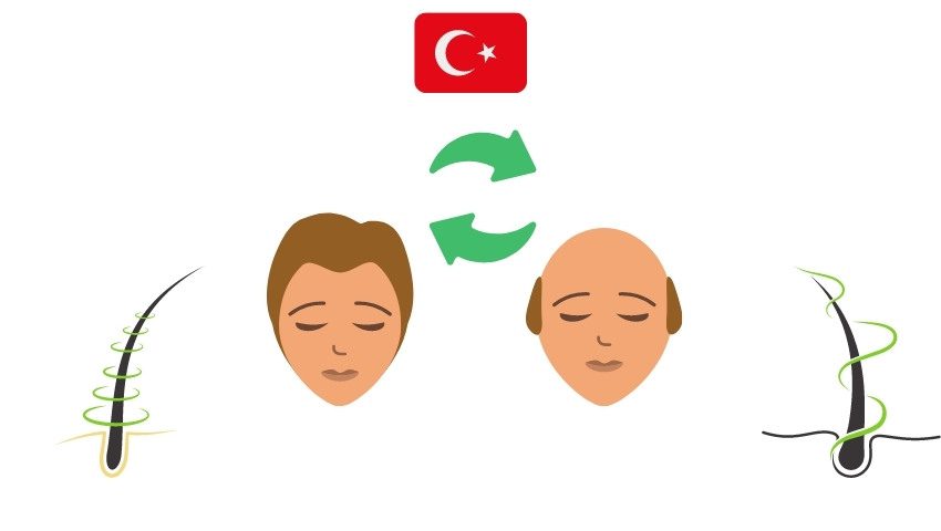 Stages and techniques of hair transplant in Turkey