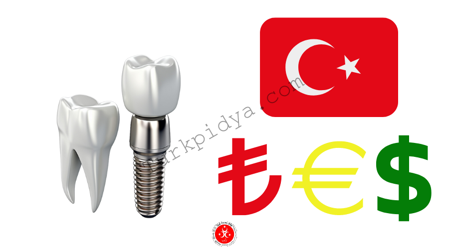 Read more about the article Ceny implantów dentystycznych w Turcji | Koszt | Najlepsze implanty | Dolar | Euro | Lira 2023